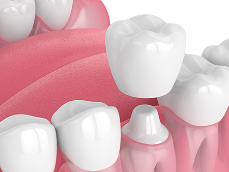 Joanna Tricorache, DDS